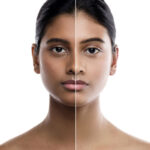 UN backs project to remove mercury from skin products